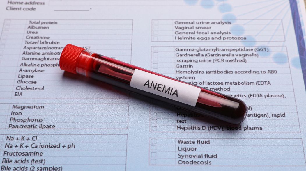 suplementy dla osob z anemia co laczyc z zelazem