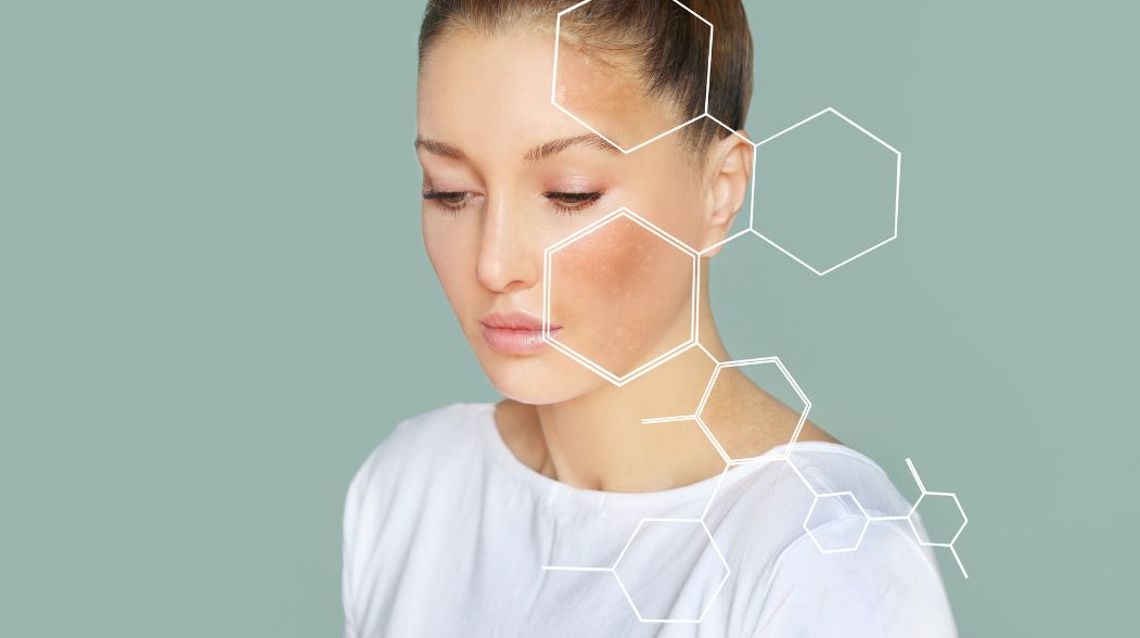 bariera hydrolipidowa jak ja odbudowac z pomoca serum