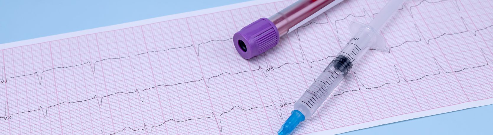 Czy blokery homocysteiny mogą wspierać profilaktykę miażdżycy?
